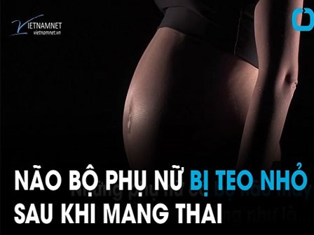 Não bộ phụ nữ bị teo nhỏ sau khi mang thai