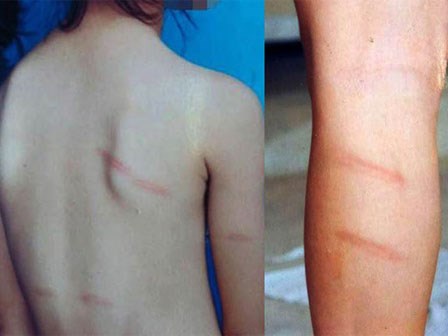 Giáo viên đẩy học sinh từ mái nhà xuống đất vì không quét lớp