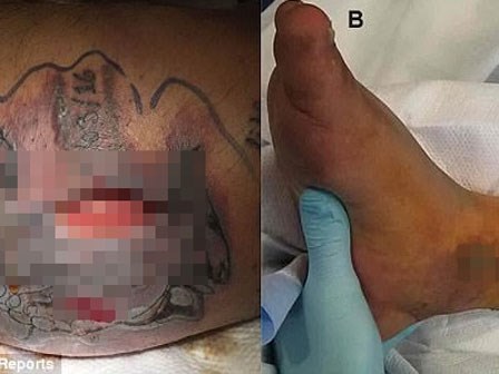 Vết xăm chưa lành đã vội vàng đi bơi, người đàn ông phải đánh đổi bằng cả mạng sống