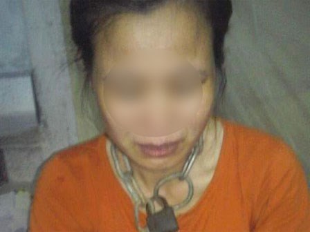 Thái Bình: Chồng dùng nhục hình xích cổ vợ, bẻ gãy tay con phải nhập viện