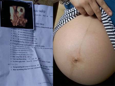 8 năm tủi nhục trước bao lời dè bỉu, cặp vợ chồng bất ngờ nhận cái kết ngọt lịm