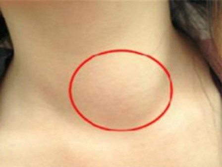 7 loại bệnh tưởng thông thường nhưng dễ chuyển thành ung thư, ai cũng nên đề phòng