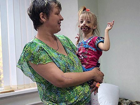 Bé gái bị xa lánh vì mắc dị tật