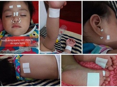 Bác sĩ nói gì về
