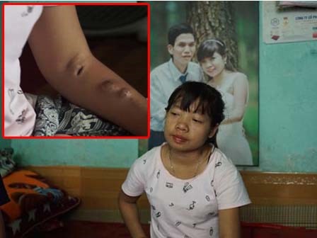 Cô gái Hà Nội 10 năm đi viện chạy thận với những ước mơ còn dang dở