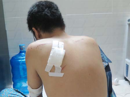 Hé lộ chân dung đại ca mới 15 tuổi của băng cướp nhí sống lang thang vừa bị triệt phá-3