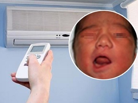 Bé gái 4 tuổi đột ngột bị méo mồm, liệt mặt sau giấc ngủ trưa trong điều hòa
