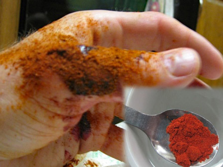 Nếu không may bị đứt tay thì đây chính xác là những gì bạn phải làm-5