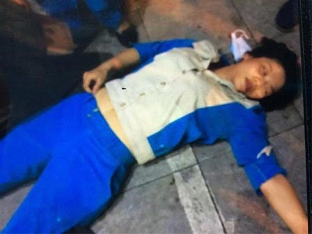 Lời kể hãi hùng của nữ công nhân môi trường bị hai vợ chồng đánh ngất xỉu chỉ vì nhắc nhở vứt rác
