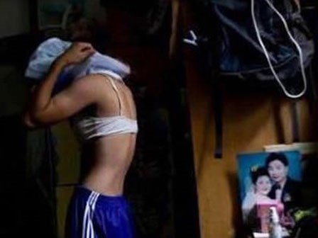 Cô gái 19 tuổi không có kinh nguyệt và sự thực khiến gia đình 'chết lặng'