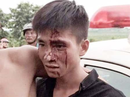 Vi phạm giao thông còn cắn vào tay CSGT