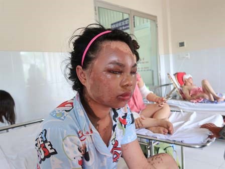 Lời kể kinh hoàng của 4 nạn nhân bị tạt a xít