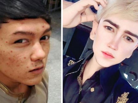 Chàng trai cầu xin mọi người ngừng sỉ vả sau khi chi 1 tỷ đồng phẫu thuật thẩm mỹ giống nhân vật hoạt hình Nhật