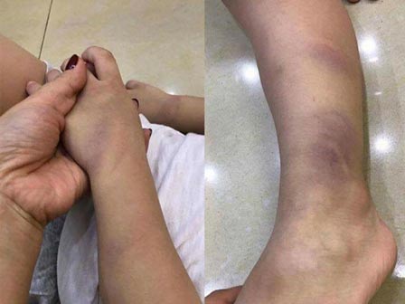 Phạt trò ăn thạch trong nhà vệ sinh, cô giáo Hưng Yên bị chấm dứt hợp đồng-1