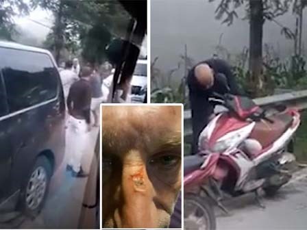 Bất ngờ với tâm thư của người bạn ông Tây bị 5 người Việt đánh ở Sa Pa
