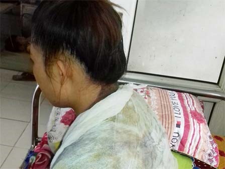 Tấn bi kịch của người phụ nữ bị chồng đòi lại tiền cưới