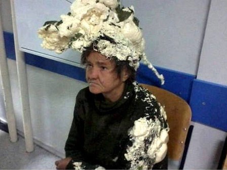 Tưởng là keo bọt, người phụ nữ vuốt nhầm keo xây dựng lên đầu, lúc sau tóc cô bú dù như tổ chim