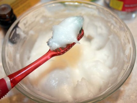 Mách bạn 2 cách làm trắng răng bằng baking soda ngay tại nhà