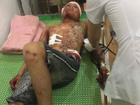 Đoàn côn đồ mang súng, dao kiếm truy sát kinh hoàng làng quê Hải Dương: Lời kể kinh hãi của nạn nhân
