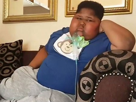 Cuộc sống hàng ngày chỉ ăn và ăn khiến cậu bé 10 tuổi đã có cân nặng quá đáng sợ