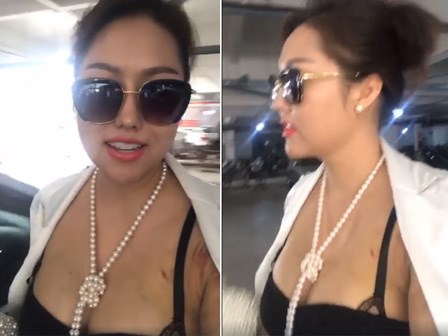 Phi Thanh Vân tự tin mặc váy bó, để lộ vết thâm sau ca đại phẫu