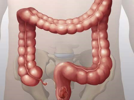 Cái chết bắt nguồn từ đại tràng: Rửa sạch độc tố trong đại tràng chỉ bằng cách ăn uống