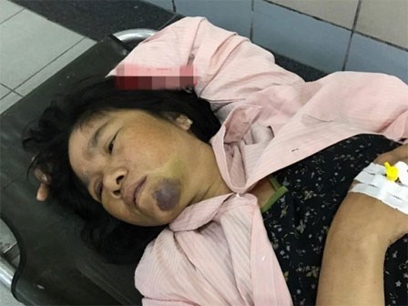 Người phụ nữ bán tăm bông bị đánh oan vì nghi bắt cóc phải cấp cứu do liên tục hoảng loạn