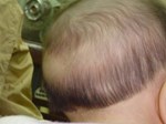 Con trai 3 tuổi đột nhiên bị rụng tóc, nguyên nhân thật sự khiến cha mẹ rất xấu hổ-4