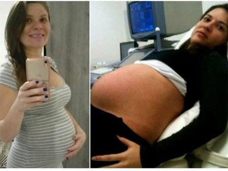 Mẹ bầu 9 tháng bị bắn xuyên tử cung, em bé vẫn sống sót một cách thần kỳ
