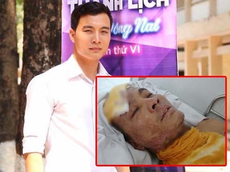 Chàng sinh viên điển trai đi làm thêm không may bị điện giật, hoại tử cơ thể