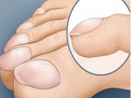 Bàn chân gặp 10 biểu hiện này chớ coi thường, bệnh trở nặng lúc nào không hay!