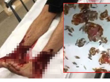 Không phải cá piranha, sinh vật biển bí ẩn ăn thịt người đang khiến nhiều người sợ hãi