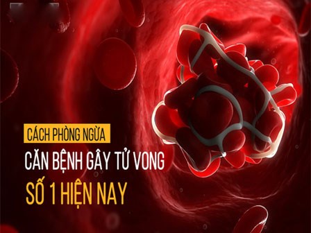 Căn bệnh trăm nghìn người chết mỗi năm ở VN: Không phải ung thư, Trung Quốc đang cảnh báo