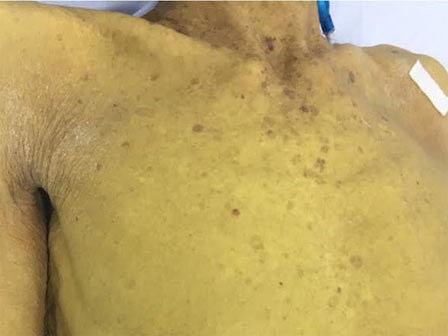 Người vàng ệch như củ nghệ vì thói quen nhà nào cũng mắc