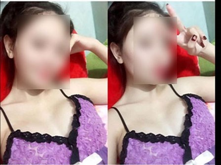 TPHCM: Chết do nâng ngực khi mang thai
