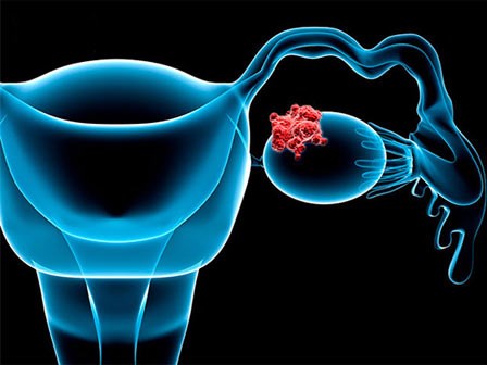 1 triệu chứng không đau báo hiệu tới 3 bệnh ung thư: Nhận ra sớm là yếu tố sống còn