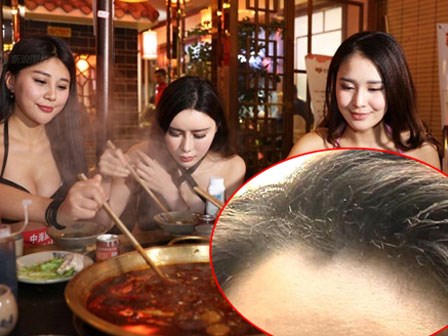 Đang ăn lẩu ngoài hàng thì lửa bùng vào mặt, cô gái trẻ bị bỏng vùng mắt, cháy sém tóc mái