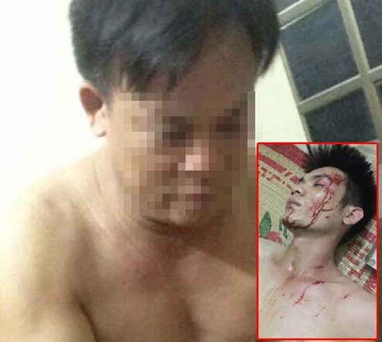 Chủ tịch xã bị phát tán ảnh “nuy” trong nhà nghỉ: “Tôi bị bôi nhọ”