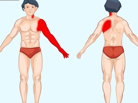 Đau ở đâu trên cơ thể thì nguy hiểm? Hình ảnh này là câu trả lời!