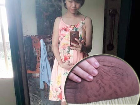 Bà mẹ 24 tuổi chia sẻ