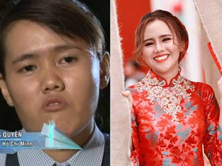 Mất tích 1 năm, cô gái 24 tuổi bị chê mặt lưỡi liềm trở về khiến mẹ nhận không ra