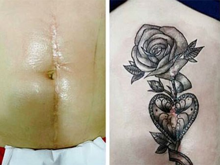 Những hình xăm kể chuyện cuộc đời: Đằng sau những bông hoa là vùng bụng rạn, vết mổ sâu sau kỳ sinh nở