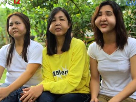 Hội bạn thân bị biến dạng mặt nghiêm trọng vì ham làm đẹp bằng phương pháp tiêm filler giá rẻ
