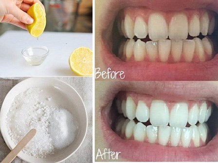Thực tế làm trắng răng chỉ với 3 phút tại nhà bằng chanh muối hiệu quả đến đâu?