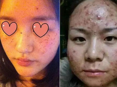 Cảnh báo: Mặt nạ giấy làm trắng giá rẻ có chứa huỳnh quang cực kì độc hại với sức khỏe