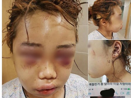 Thêm thông tin chi tiết về vụ nữ sinh 14 tuổi bị bạo hành gây rúng động Hàn Quốc những ngày qua