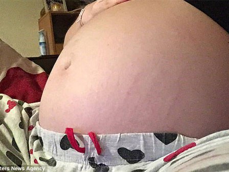 Tưởng mang bầu 8 tháng, bà mẹ giật mình phát hiện thứ kinh dị này trong bụng