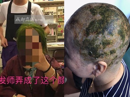 Nhuộm tóc 4 lần trong 7 tiếng để có màu xanh lá, người phụ nữ bị sốc phản vệ và cái kết không mong muốn