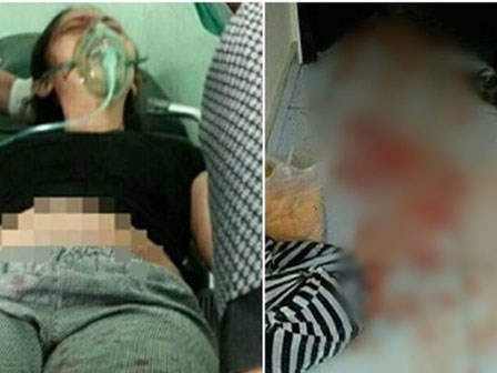 Sốc: Chồng chặt cụt chân vợ ngay trước mặt con vì nghi ngoại tình