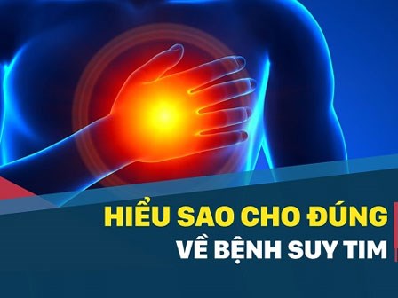 Hiểu sao cho đúng về bệnh suy tim?